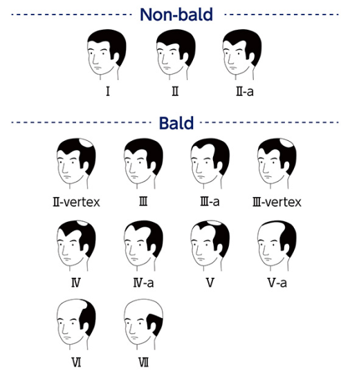 髪型分類 図